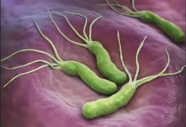 Green bacteria with multiple tail-like flagella on a purple surface representing Helicobacter pylori bacteria